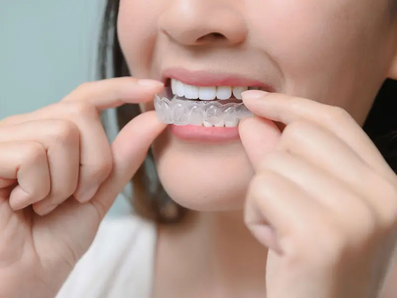 Orthodontics / Invisalign