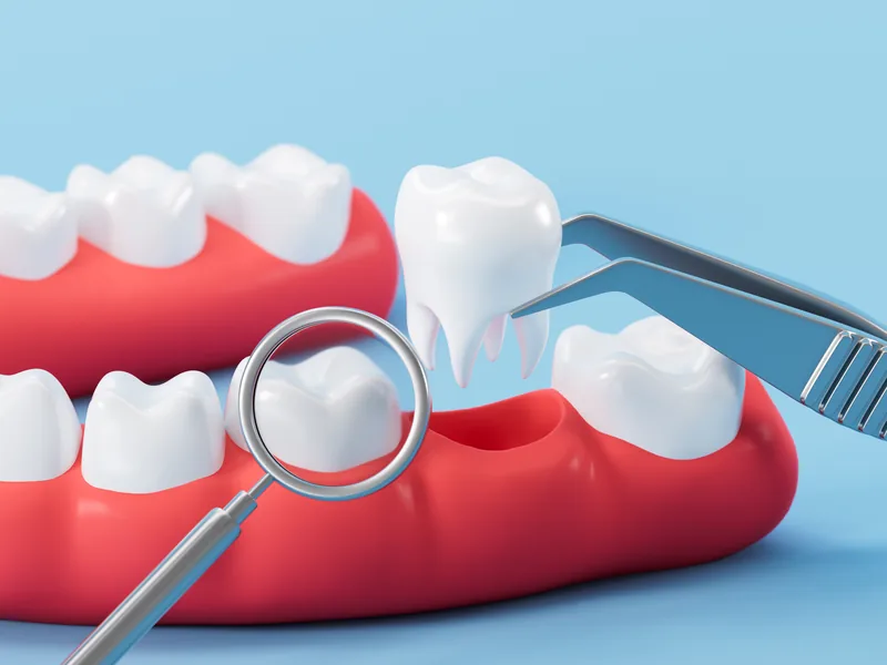A dental model of teeth with a dental mirror and forceps